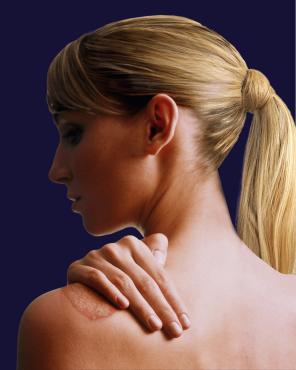 Woman Rubbing Her Shoulder